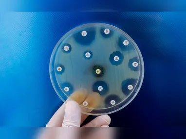 Larissa Dell’Antonio afirmou que a ocorrência da doença está associada a fatores como  idade e histórico familiar