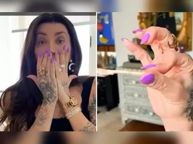 Ruth Codd fez sua primeira amputação aos 23 anos, após sofrer uma lesão no pé jogando futebol na adolescência