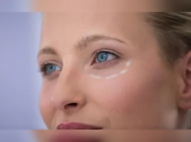 Imagem ilustrativa da imagem Técnicas sem cortes para olhar mais jovem e natural: as novidades da estética