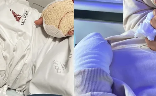 Imagem ilustrativa da imagem Estudante brasileiro de 9 anos tem dois dedos decepados em escola de Portugal