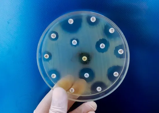 Imagem ilustrativa da imagem Após morte de menina, Praia Grande confirma 2º caso de meningite bacteriana