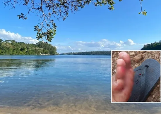 Imagem ilustrativa da imagem Banhistas relatam mordidas e temem presença de piranhas em lagoa de Linhares