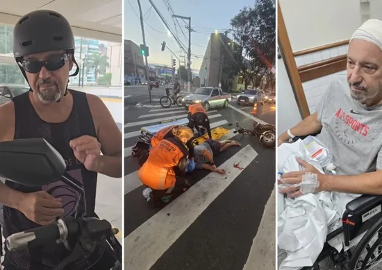 Imagem ilustrativa da imagem Chef de cozinha faz alerta após acidente com moto elétrica: "Usem capacete"