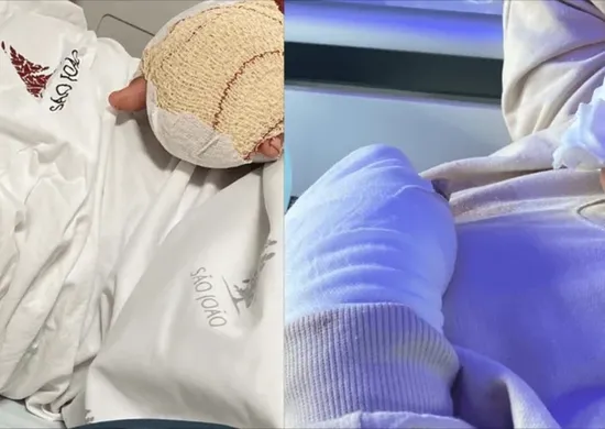 Imagem ilustrativa da imagem Estudante brasileiro de 9 anos tem dois dedos decepados em escola de Portugal