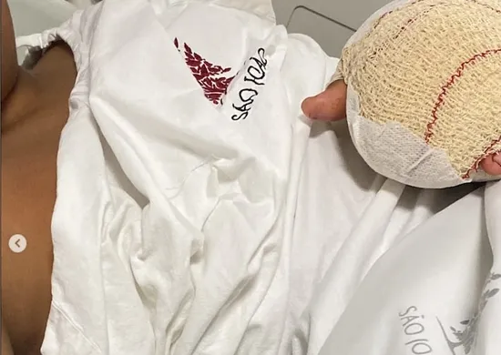 Imagem ilustrativa da imagem Governo de Portugal investiga caso de menino brasileiro que teve dedos mutilados