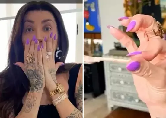 Imagem ilustrativa da imagem Maya Massafera mostra resultado após retirar ossos do rosto