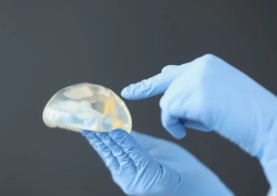 Imagem ilustrativa da imagem Mulheres retiram silicone para recuperar visual natural