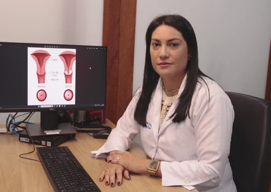 Imagem ilustrativa da imagem O que muda na prevenção do câncer de colo de útero