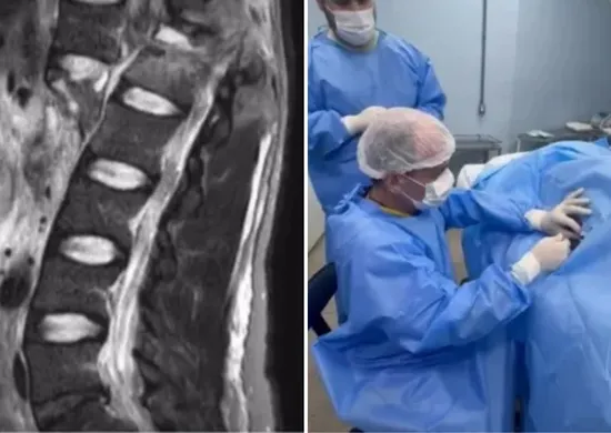 Imagem ilustrativa da imagem Paciente que recebeu polilaminina relata emoção ao mexer o pé e a perna