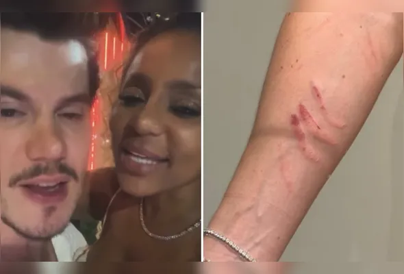 Imagem ilustrativa da imagem Cariúcha acusa médico de agressão; ele nega e afirma ter sido arranhado pela