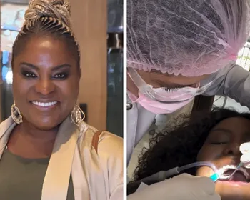 Imagem ilustrativa da imagem Ex-Rouge enfrenta imprevisto dental antes do Carnaval