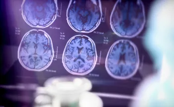 Imagem ilustrativa da imagem Alzheimer é a segunda doença mais temida pelos brasileiros, atrás apenas do câncer