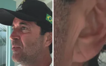 Imagem ilustrativa da imagem Entenda o sinal que pode significar risco de infarto