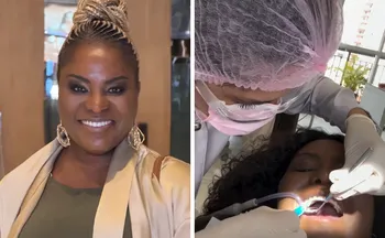 Imagem ilustrativa da imagem Ex-Rouge enfrenta imprevisto dental antes do Carnaval