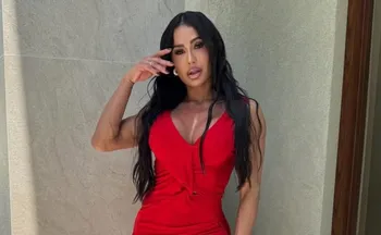 Imagem ilustrativa da imagem Famosos voltam atrás e revertem procedimentos estéticos em busca de naturalidade