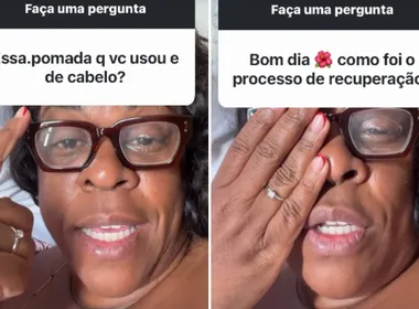 Imagem ilustrativa da imagem Cacau Protásio volta a enxergar após cegueira temporária e faz alerta sobre produto