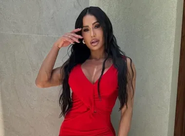 Imagem ilustrativa da imagem Famosos voltam atrás e revertem procedimentos estéticos em busca de naturalidade