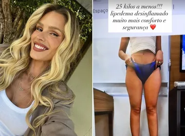 Imagem ilustrativa da imagem Yasmin Brunet revela ter perdido 25 kg em tratamento contra lipedema