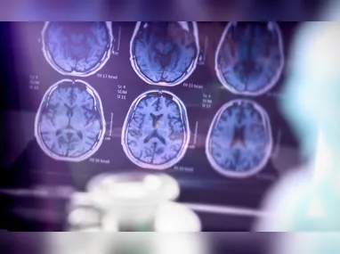 Imagem ilustrativa da imagem Alzheimer é a segunda doença mais temida pelos brasileiros, atrás apenas do câncer