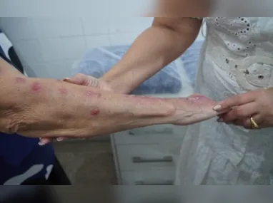 A mesma tendência se confirmou nos questionamentos a respeito de insônia: 36,2% das mulheres, contra 26,2% dos homens