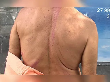 Momento do acidente entre os veículos no cruzamento em Jardim Camburi