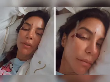 Evaristo respondeu sobre unha preta em seus stories do Instagram