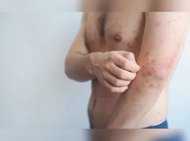 Priscila Pessanha diz que crianças e adolescentes com diabetes tipo 2 e obesidade ou sobrepeso terão benefícios