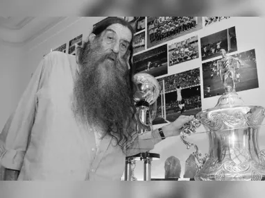 Ivete mostrou cortes no rosto após queda