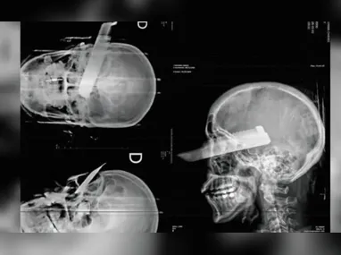 Se aprovado pelo colegiado, Ibaneis será obrigado a comparecer