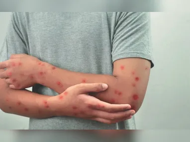 Maria da Penha Rodrigues, de 71 anos, finalizou o tratamento contra o câncer há três anos