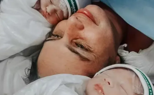 Imagem ilustrativa da imagem Gêmeos nascem empelicados em hospital de Vitória; caso é considerado raro