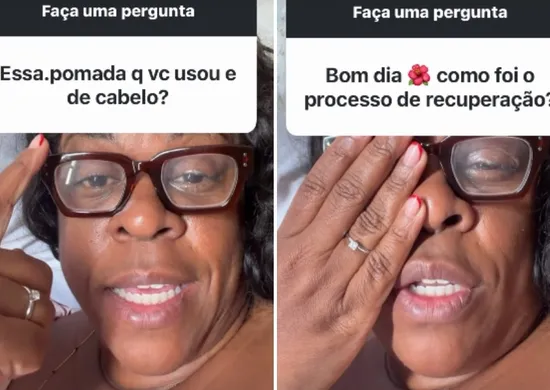 Imagem ilustrativa da imagem Cacau Protásio volta a enxergar após cegueira temporária e faz alerta sobre produto