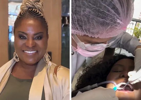 Imagem ilustrativa da imagem Ex-Rouge enfrenta imprevisto dental antes do Carnaval