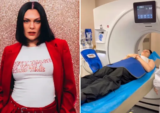 Imagem ilustrativa da imagem Jessie J bate a cabeça e vai parar no hospital na China
