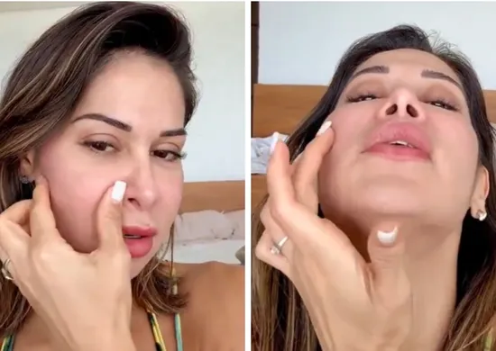 Imagem ilustrativa da imagem Maíra Cardi passará por cirurgia delicada após deformação no rosto
