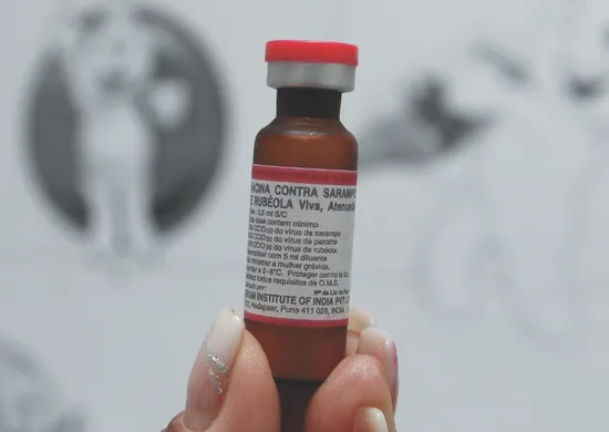 Imagem ilustrativa da imagem Médicos explicam risco de surto de sarampo