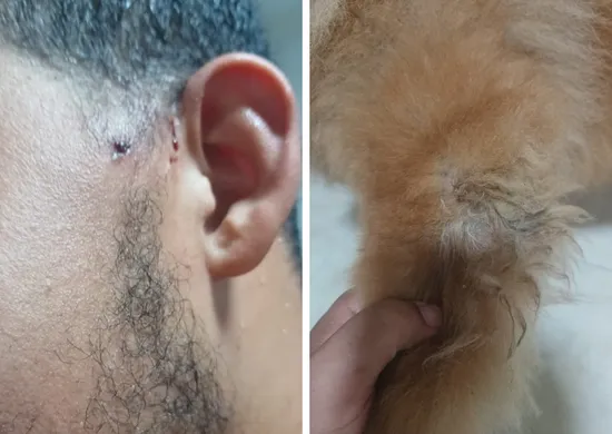 Imagem ilustrativa da imagem Pitbull ataca jovem e chow-chow duas vezes no Perocão, em Guarapari