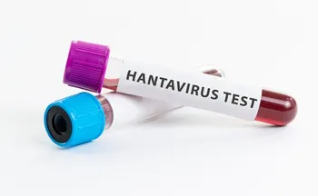 Imagem ilustrativa da imagem Hantavírus: OMS confirma oito casos de cepa que causou surto em navio