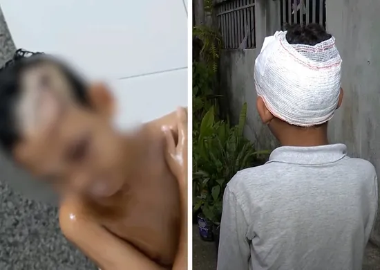 Imagem ilustrativa da imagem Menino de 8 anos é atacado por cachorro em Vila Velha e fica ferido