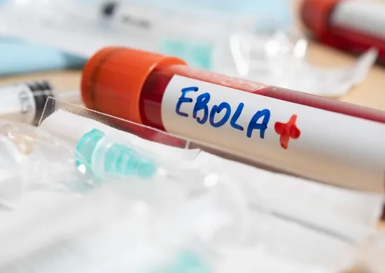 Imagem ilustrativa da imagem Secretário de Trump critica OMS por surto de ebola no Congo: 'Demora'