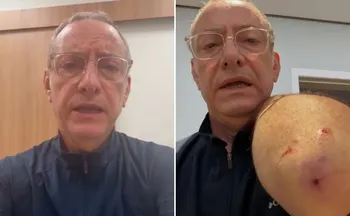 Imagem ilustrativa da imagem Jornalista José Roberto Burnier é atacado por pitbull: 'irresponsabilidade'