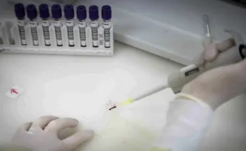 Imagem ilustrativa da imagem Secretaria de Saúde de SP investiga novo caso suspeito de ebola