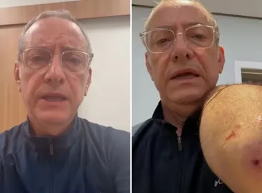 Imagem ilustrativa da imagem Jornalista José Roberto Burnier é atacado por pitbull: 'irresponsabilidade'