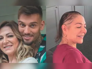 Imagem ilustrativa da imagem Alopecia: causas e tratamentos da doença que afeta famosos