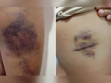 Suspeito foi identificado por reconhecimento facial e o levou à Delegacia Regional; filha de 6 anos foi entregue à tia com aval do Conselho Tutelar