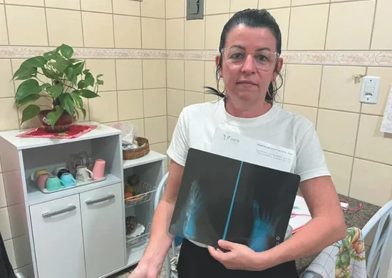 Imagem ilustrativa da imagem "A maior sequela ficou na mente", conta servidora que sobreviveu a acidente