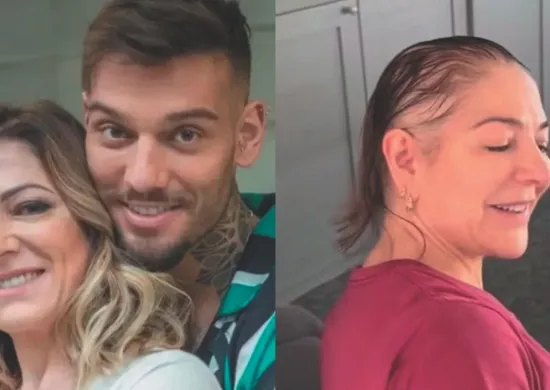 Imagem ilustrativa da imagem Alopecia: causas e tratamentos da doença que afeta famosos