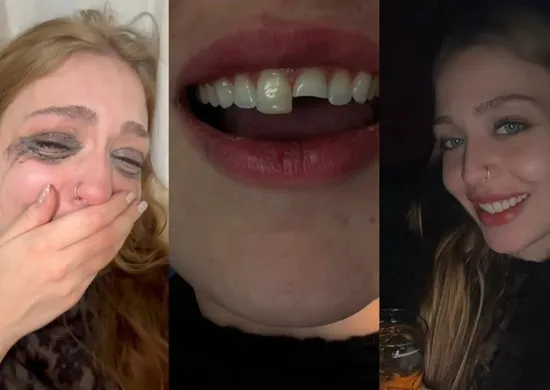Imagem ilustrativa da imagem Jovem quebra dente na balada, cola na madrugada e volta para a festa