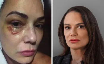 Imagem ilustrativa da imagem Luiza Brunet comenta indenização de R$ 150 mil por agressão de ex