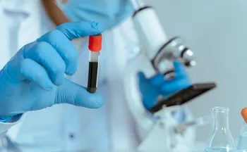 Imagem ilustrativa da imagem Novo exame para diagnosticar Alzheimer no chega ao país